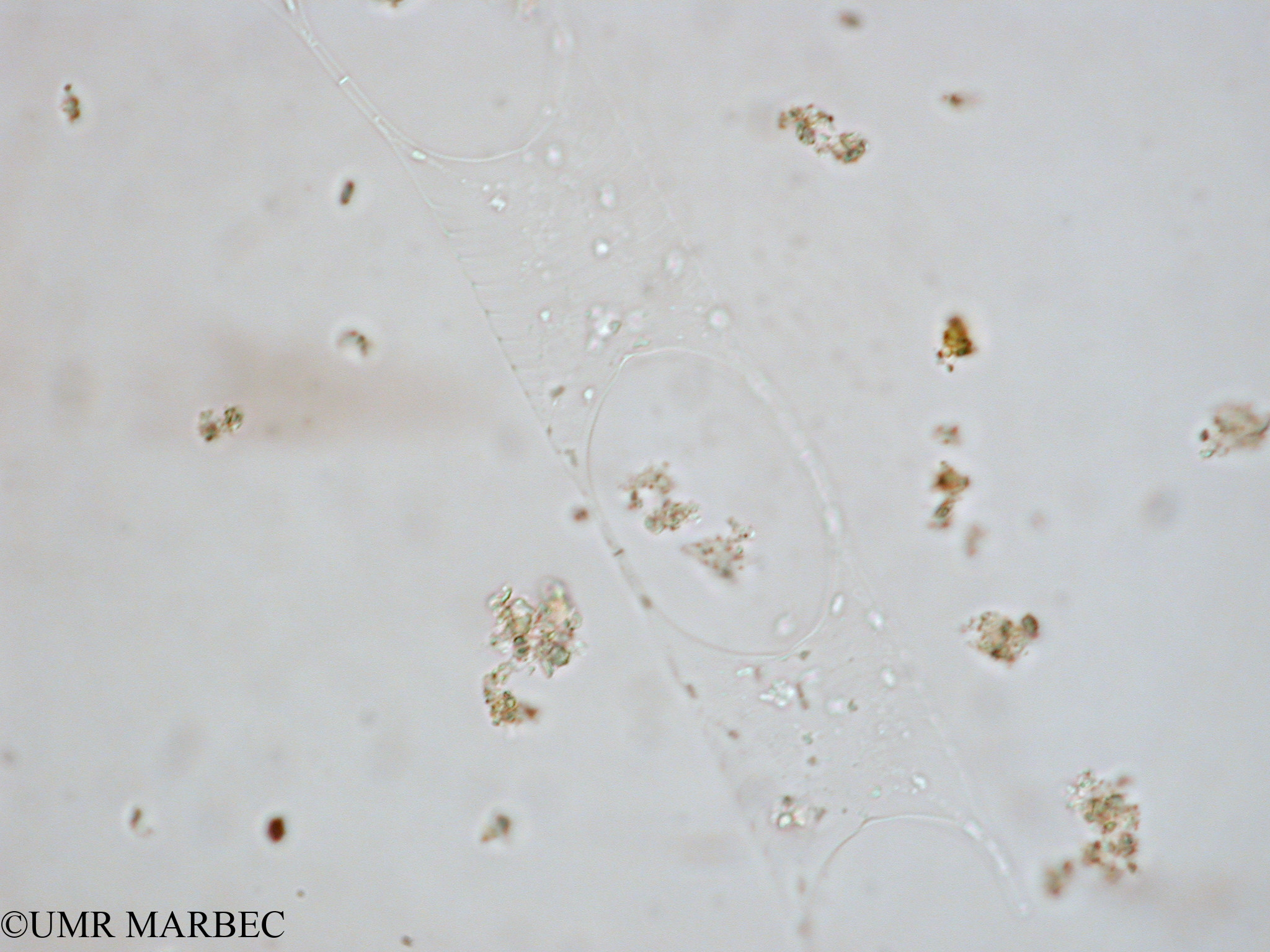 phyto/Tulear Lagoon/all/ICAR2 Avril 2008/Eucampia cornuta (Hemiaulus sp2 x1.5x40 g)(copy).jpg